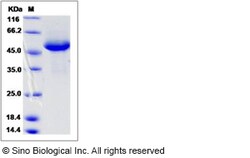 Sino Biological Recombinant Human RAB27B Protein (mFc Tag), Quantity: Each