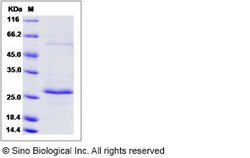 Sino Biological Recombinant Human RAB27B Protein, Quantity: Each of 1