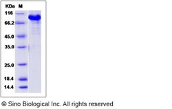 Sino Biological Recombinant Human KIAA1279 Protein (His & GST Tag), Quantity: