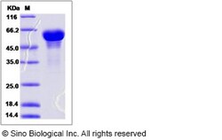Sino Biological Recombinant Human Secretogranin 3 Protein (His Tag), Quantity: