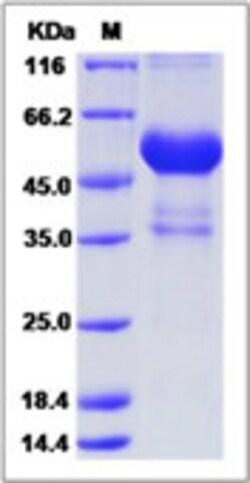 Sino Biological Human Cardiotrophin-1 / CTF1 Protein (Fc Tag) 100ug, Quantity:
