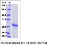 Sino Biological Human Cardiotrophin-1 / CTF1 Protein 100ug, Quantity: Each