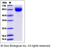 Sino Biological Human LILRB1 / CD85 / ILT2 / ILR1 Protein (ECD, His Tag)