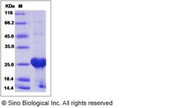Sino Biological Human Rab6 / Rab GTPases / RAB6A Protein (His Tag) 50ug,