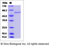 Sino Biological Recombinant Human CD39/ENTPD1 Protein (ECD, His Tag), HPLC-verified,