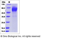 Sino Biological Human CALCR / Calcitonin receptor Protein (Fc Tag) 100ug,