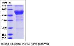 Sino Biological Recombinant Human CD300f/LMIR3 Protein (hFc Tag), Quantity: