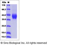 Sino Biological Human HEPACAM Protein (ECD, His Tag) 100ug, Quantity: Each