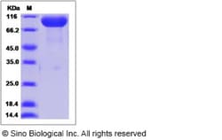 Sino Biological Recombinant Human NCAM2 Protein (His Tag), Quantity: Each