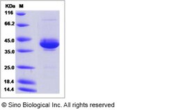 Sino Biological Human NRG-3 / Neuregulin-3 Protein (Fc Tag) 100ug, Quantity: