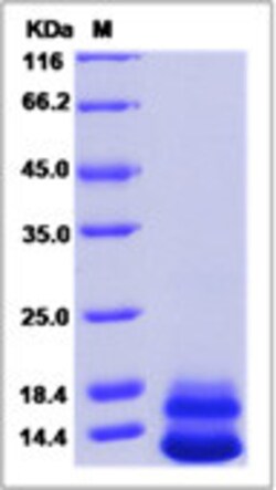 Sino Biological Recombinant Human Neuregulin-3/NRG3 Protein (His Tag),