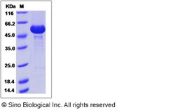 Sino Biological Recombinant Human RANK/TNFRSF11A Protein (hFc Tag), HPLC-verified