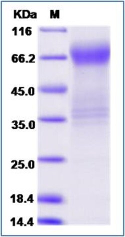 Sino Biological Human MILR1 / Allergin 1 Protein (Fc Tag) 100ug, Quantity: