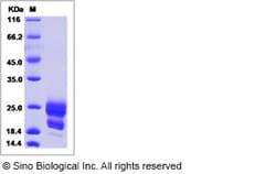 Sino Biological Recombinant Human CEACAM19 Protein (ECD, His Tag), Quantity: