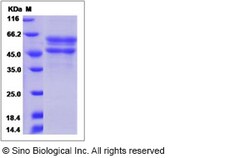 Sino Biological Recombinant Human IGFLR1 Protein (hFc Tag), Quantity: Each