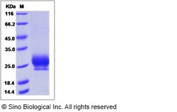 Sino Biological Recombinant Human RNF43 Protein (His Tag), HPLC-verified,