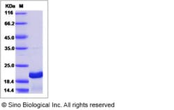 Sino Biological Human GH1 Protein, Quantity: Each of 1