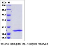 Sino Biological Human FGF8a / FGF-8a Protein 50ug, Quantity: Each of 1