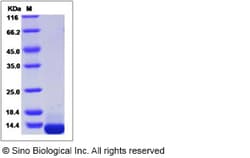 Sino Biological Recombinant Human COL6A3 Protein (His Tag), Quantity: Each