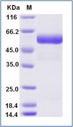 Sino Biological Human ROR2 Protein (His & AVI Tag), Biotinylated 100ug,