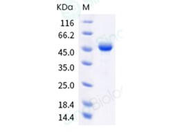 Sino Biological Human TSLP Protein (R127A, R130S, Fc Tag) 100ug, Quantity: