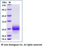 Sino Biological Human TSLP Protein (R127A, R130S, His Tag) 500ug, Quantity: