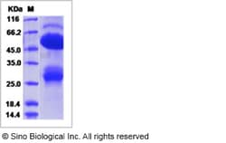 Sino Biological Recombinant Human GGT5 Protein (ECD, His Tag), Quantity: