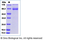 Sino Biological Recombinant Human ITIH3 Protein (hFc Tag), Quantity: Each