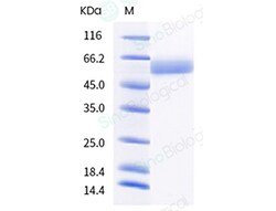 Sino Biological Recombinant Human B7-H7/HHLA2 Protein (ECD, His Tag), Amine-Labeled