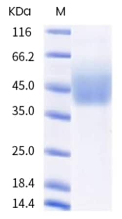 Sino Biological Human NCR3LG1 Protein 20ug (Sino Biological), Quantity: