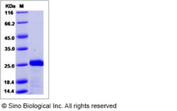 Sino Biological Recombinant Human MTH1 Protein (His Tag), Quantity: Each