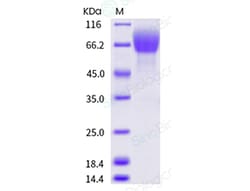 Sino Biological Recombinant Human FGFR1 Protein (alpha (IIIb), His Tag),