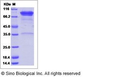 Sino Biological Recombinant Human LAG-3 Protein (ECD, mFc Tag), HPLC-verified,