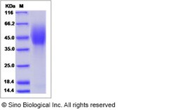 Sino Biological Human NPC1 Protein (His & FLAG Tag) 100ug, Quantity: Each
