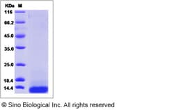 Sino Biological Human TFF3/Trefoil Factor 3 Protein (His Tag) 50ug, Quantity:
