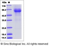 Sino Biological Recombinant Human ILT3/LILRB4 Protein (ECD, hFc Tag), HPLC-verified,
