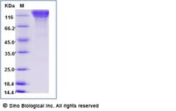 Sino Biological Human CD45-AB Protein (His Tag) 100ug, Quantity: Each of