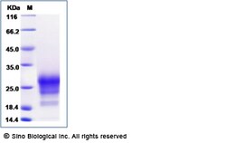 Sino Biological Recombinant Human Thy1/CD90 Protein (His Tag), HPLC-verified,