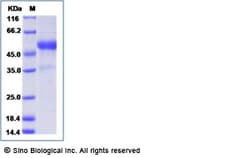 Sino Biological Human TL1A / TNFSF15 Protein (mFc Tag) 100ug, Quantity: