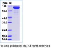 Sino Biological Recombinant Human Factor B Protein (His Tag), HPLC-verified,