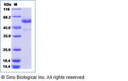 Sino Biological Recombinant Human TSHR Protein (ECD, His Tag), Quantity:
