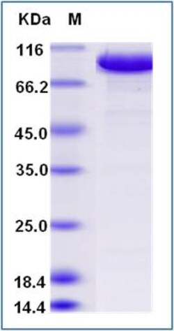 Sino Biological Human TOP1 Protein (His Tag) 100ug, Quantity: Each of 1