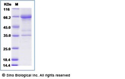 Sino Biological Recombinant Human MIS/AMH Protein (His Tag), Quantity: