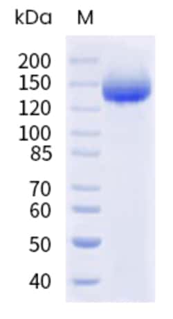 Sino Biological Human NPHS1 Protein 100ug (Sino Biological), Quantity: