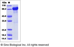 Sino Biological Recombinant Human GAD65/GAD2 Protein (GST Tag), Quantity:
