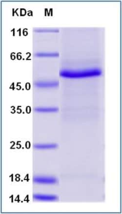 Sino Biological Recombinant Human TRIM21 Protein (His Tag), Quantity: Each