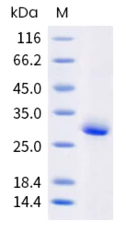Sino Biological Human IL15RA Protein (ECD, His Tag) 100µg, Quantity: Each