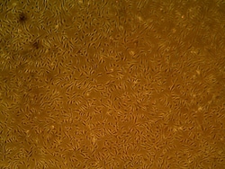 Cell Systems Corporation Primary Human Retinal Pericyte Cells (ACBRI 183