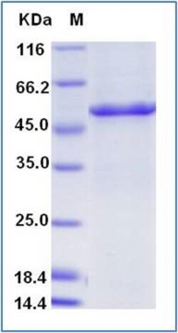 Sino Biological Human DBT Protein (His Tag) 100ug, Quantity: Each of 1