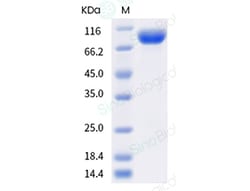 Sino Biological Recombinant Human CCK4/PTK7 Protein (His Tag), HPLC-verified,